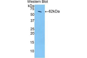 Western blot analysis of the recombinant protein. (HSD17B12 抗体  (AA 1-312))