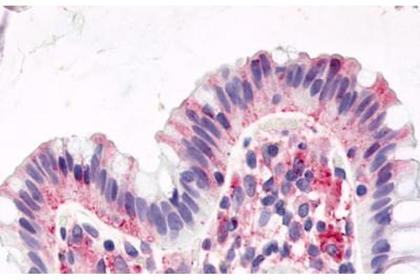 GPR15 抗体  (Cytoplasmic Domain)