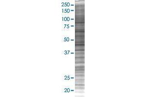 MYL6B transfected lysate. (MYL6B 293T Cell Transient Overexpression Lysate(Denatured))