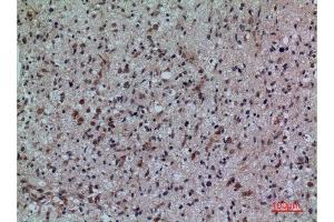 Immunohistochemistry (IHC) analysis of paraffin-embedded Human Brain, antibody was diluted at 1:100. (FCRL5 抗体  (Internal Region))