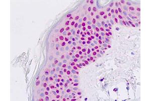 Anti-PAX7 antibody IHC staining of human skin, epidermis. (PAX7 抗体  (AA 410-437))