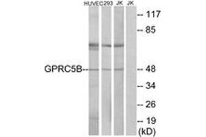 Western Blotting (WB) image for anti-G Protein-Coupled Receptor, Family C, Group 5, Member B (GPRC5B) (AA 61-110) antibody (ABIN2890862) (GPRC5B 抗体  (AA 61-110))