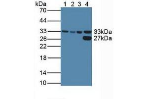 Figure. (CDK2 抗体  (AA 94-198))