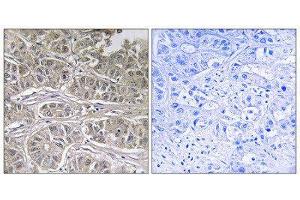 Immunohistochemistry (IHC) image for anti-Solute Carrier Family 25 (Mitochondrial Oxodicarboxylate Carrier), Member 21 (Slc25a21) (Internal Region) antibody (ABIN1851571) (SLC25A21 抗体  (Internal Region))