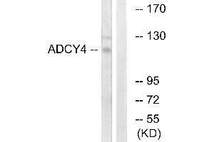 Western blot analysis of extracts from Jurkat cells, using ADCY4 antibody. (ADCY4 抗体)