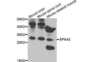 Western Blotting (WB) image for anti-Ephrin A3 (EFNA3) (AA 23-214) antibody (ABIN6219775) (Ephrin A3 抗体  (AA 23-214))