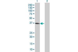 Lane 1: CFHR1 transfected lysate ( 34. (CFHR1 293T Cell Transient Overexpression Lysate(Denatured))