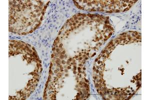 Immunostaining (ISt) image for anti-Stress-Induced-phosphoprotein 1 (STIP1) (AA 1-543) antibody (ABIN564756)