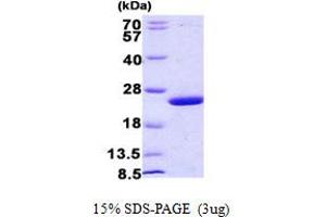 SDS-PAGE (SDS) image for MUG (AA 1-168) protein (His tag) (ABIN5852933) (MUG (AA 1-168) protein (His tag))