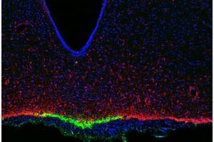 Image no. 3 for anti-Interferon gamma (IFNG) antibody (ABIN465463) (Interferon gamma 抗体)