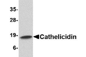 Western Blotting (WB) image for anti-Cathelicidin Antimicrobial Peptide (CAMP) (C-Term) antibody (ABIN1030321) (Cathelicidin 抗体  (C-Term))