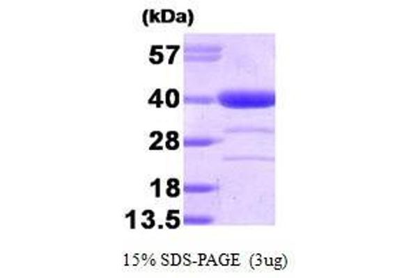 Alcohol Dehydrogenase (ADH) (AA 1-325) 蛋白