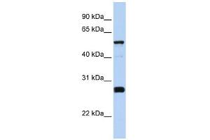 FAM83F antibody used at 1 ug/ml to detect target protein. (FAM83F 抗体  (Middle Region))