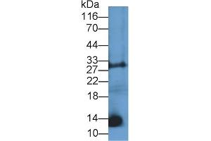 Detection of CNP in Mouse Liver lysate using Polyclonal Antibody to C-Type Natriuretic Peptide (CNP) (NPPC 抗体  (AA 33-125))