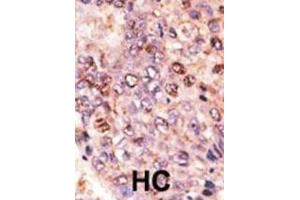 Immunohistochemistry (IHC) image for anti-ATP-Binding Cassette, Sub-Family B (MDR/TAP), Member 7 (ABCB7) antibody (ABIN3002511) (ABCB7 抗体)