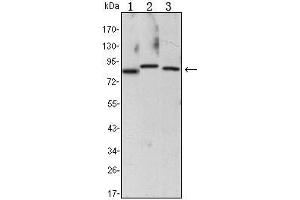 Western Blot showing CHUK antibody used against Raji (1), Jurkat (2) and THP-1 (3) cell lysate. (IKK alpha 抗体)