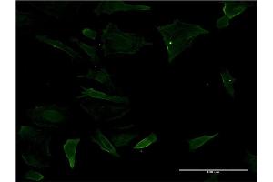 Immunofluorescence of monoclonal antibody to CD19 on HeLa cell. (CD19 抗体  (AA 98-187))