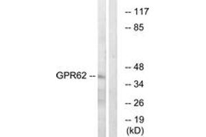 Western Blotting (WB) image for anti-G Protein-Coupled Receptor 62 (GPR62) (AA 181-230) antibody (ABIN2890876) (GPR62 抗体  (AA 181-230))