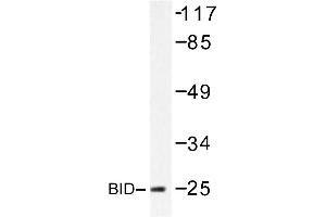 Image no. 1 for anti-BH3 Interacting Domain Death Agonist (BID) antibody (ABIN272120) (BID 抗体)