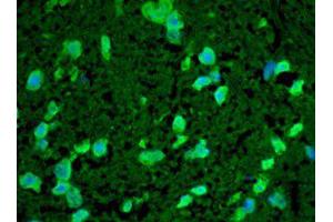 Immunofluorescence (IF) image for anti-Heat Shock 22kDa Protein 8 (HSPB8) antibody (ABIN6656214)