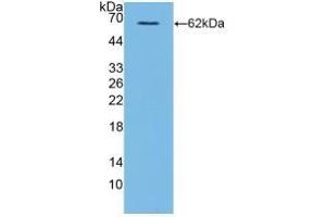 Detection of Recombinant CD40L, Human using Polyclonal Antibody to Cluster Of Differentiation 40 Ligand (CD40L) (CD40 Ligand 抗体  (AA 1-261))
