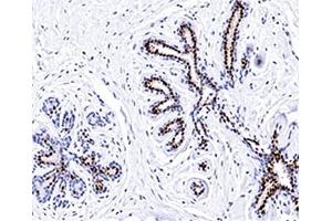 IHC testing of normal human breast stained with Progesterone receptor antibody (PR501). (Progesterone Receptor 抗体)