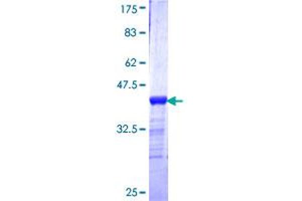 PCMT1 Protein (AA 117-225) (GST tag)