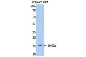 Western Blotting (WB) image for anti-Renin (REN) (AA 265-386) antibody (ABIN1860433) (Renin 抗体  (AA 265-386))