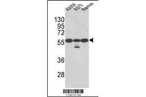 Western blot analysis of PDIA3 Antibody in A2058, A375, Ramos cell line lysates (35ug/lane)(2ug/ml) (PDIA3 抗体  (AA 192-220))