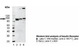 Image no. 1 for anti-Insulin Receptor (INSR) (Cytoplasmic Domain) antibody (ABIN331470) (Insulin Receptor 抗体  (Cytoplasmic Domain))