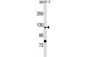 Western Blotting (WB) image for anti-Solute Carrier Family 4, Sodium Bicarbonate Cotransporter, Member 9 (SLC4A9) antibody (ABIN2999782) (SLC4A9 抗体)