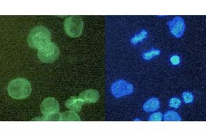 Immunocytochemistry staining of alpha-tubulin in K562 cells using purified rat monoclonal antibody YOL1/34 (concentration in sample 6 μg/mL, DAR FITC, left picture) vs. (alpha Tubulin 抗体)