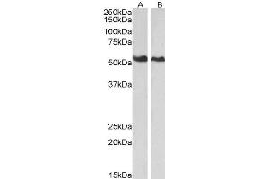 ABIN2561121 (0. (Annexin A11 抗体  (N-Term))