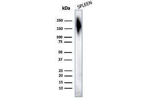 Western Blotting (WB) image for anti-Protein tyrosine Phosphatase, Receptor Type, C (PTPRC) antibody (ABIN6940460)