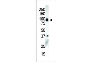 Western blot analysis of anti-PKCnu C-term Pab in NCI-H460 cell lysate (PRKD3 抗体  (C-Term))