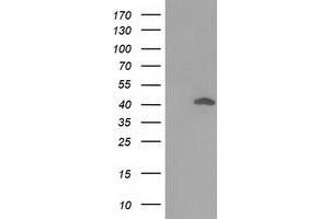 Western Blotting (WB) image for anti-DnaJ (Hsp40) Homolog, Subfamily B, Member 1 (DNAJB1) antibody (ABIN1498735) (DNAJB1 抗体)
