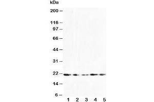 Western blot testing of FGF10 antibody and Lane 1:  U87;  2: HeLa;  3: A549;  4: 293T;  5: HeLa cell lysate (FGF10 抗体  (N-Term))