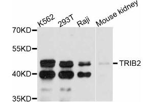 Western blot analysis of extracts of various cell lines, using TRIB2 antibody (ABIN4905491) at 1:3000 dilution. (TRIB2 抗体)