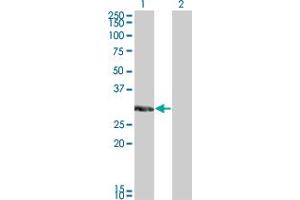 Western Blotting (WB) image for anti-Kv Channel Interacting Protein 2 (KCNIP2) (AA 1-100) antibody (ABIN466204) (KCNIP2 抗体  (AA 1-100))