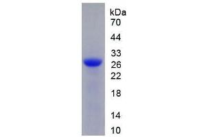 SDS-PAGE (SDS) image for Deoxyribonuclease I (DNASE1) (AA 19-259) protein (His tag) (ABIN1170313) (DNASE1 Protein (AA 19-259) (His tag))