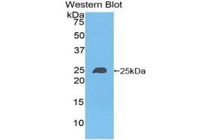 Western Blotting (WB) image for anti-Non Metastatic Cells 6, Protein Expressed In (AA 3-182) antibody (ABIN1860011) (Non Metastatic Cells 6, Protein Expressed In (AA 3-182) 抗体)