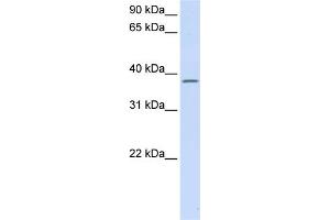 WB Suggested Anti-C21orf91 Antibody Titration:  0. (C21orf91 抗体  (Middle Region))