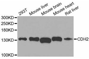 Western blot analysis of extracts of various cell lines, using CDH2 antibody (ABIN5995676) at 1/1000 dilution. (N-Cadherin 抗体)
