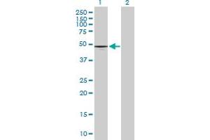 Western Blot analysis of CD177 expression in transfected 293T cell line by CD177 MaxPab polyclonal antibody. (CD177 抗体  (AA 1-437))