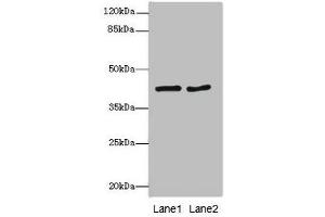 Western blot All lanes: MTCH1antibody at 2. (MTCH1 抗体  (AA 100-250))