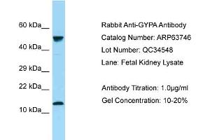 Western Blotting (WB) image for anti-Glycophorin A (GYPA) (N-Term) antibody (ABIN2789608) (CD235a/GYPA 抗体  (N-Term))