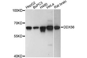 Western blot analysis of extracts of various cell lines, using DDX56 antibody (ABIN5996684) at 1:3000 dilution. (DDX56 抗体)