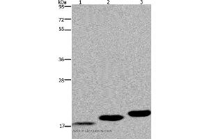 Western blot analysis of Mouse skeletal muscle, heart and bladder tissue, using MYL12B Polyclonal Antibody at dilution of 1:450 (MYL12B 抗体)