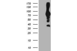 HEK293T cells were transfected with the pCMV6-ENTRY control (Left lane) or pCMV6-ENTRY PFKP (Right lane) cDNA for 48 hrs and lysed. (PFKP 抗体)