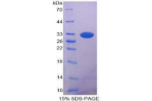 SDS-PAGE (SDS) image for Pancreatic Lipase (PNLIP) (AA 47-280) protein (His tag) (ABIN2125699) (PNLIP Protein (AA 47-280) (His tag))